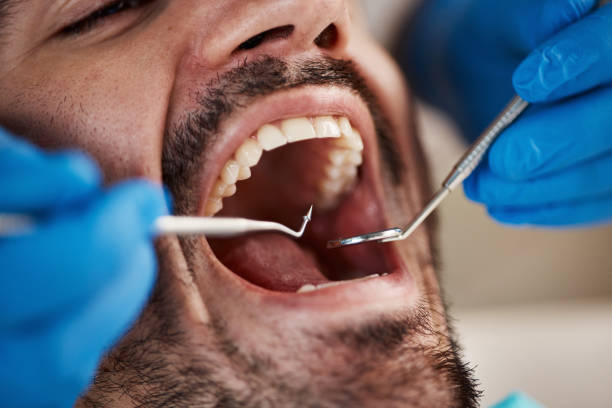 Best Emergency Dental Care for Broken or Chipped Teeth in Eerlin, ND