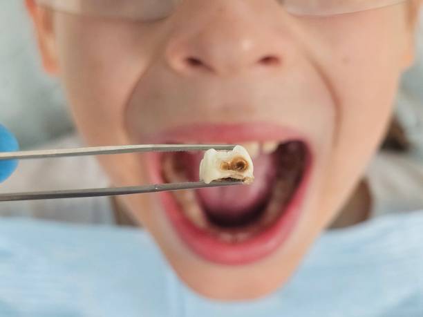 Best Cosmetic Emergency Dentistry in Eerlin, ND